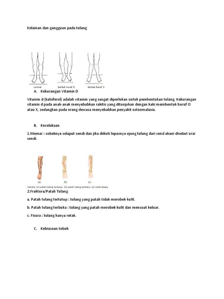Kelainan Tulang | PDF