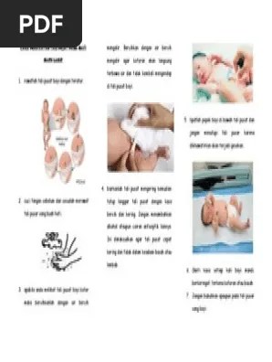 Cara Perawatan Tali Pusat Pada Bayi Baru Lahir | PDF