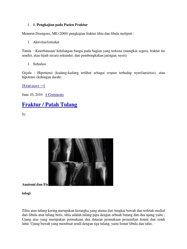 Fraktur Tibia Fibula | PDF