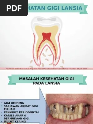 Kesehatan Gigi Lansia | PDF