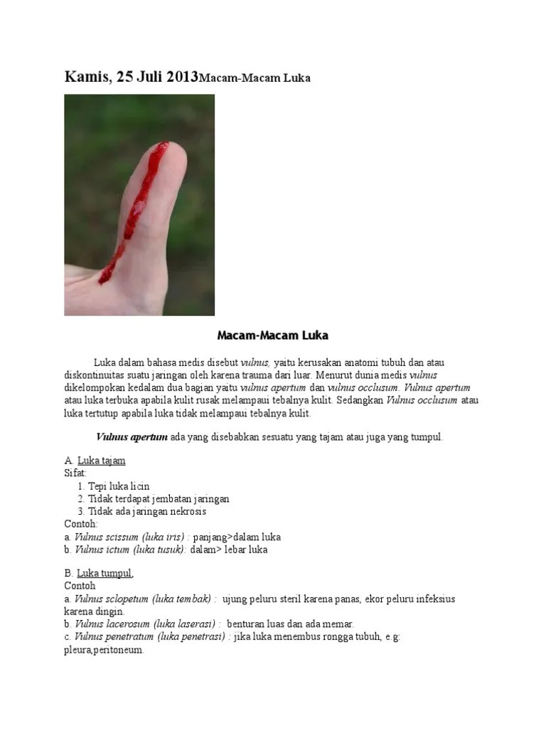 Jenis Luks | PDF
