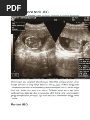 Cara Membaca Hasil USG | PDF