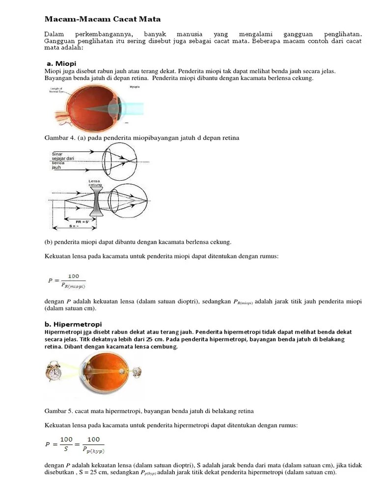 Macam Macam Cacat Mata | PDF
