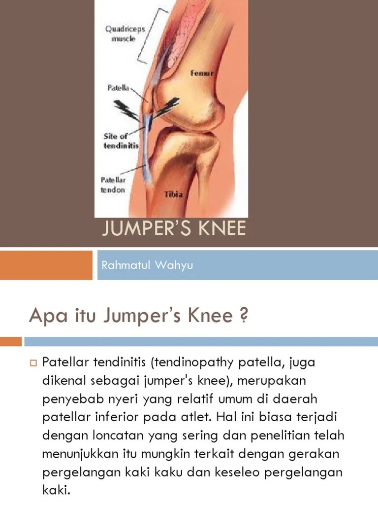Jumper&rsquo;s Knee (Rahmatul Wahyu) | PDF