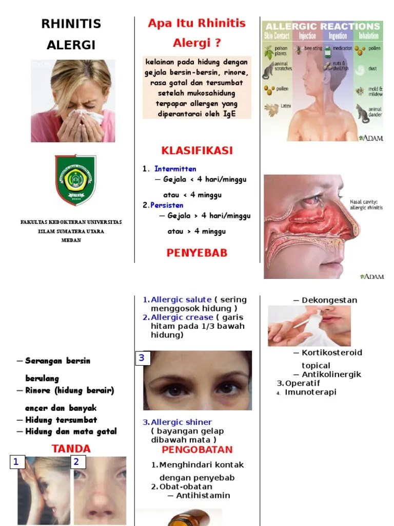 RHINITIS ALERGI Brosur | PDF