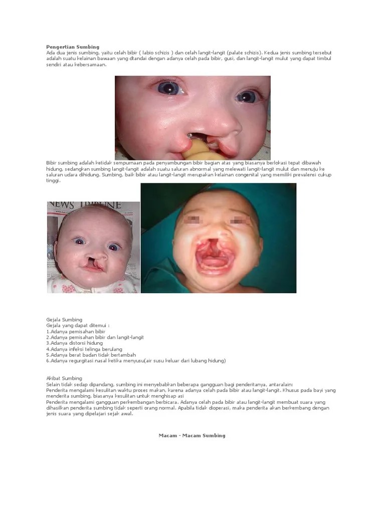 Pengertian Sumbingn | PDF