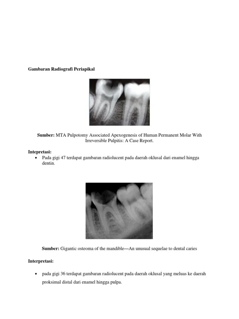 Tugas Radiologi Kedokteran Gigi 2 | PDF