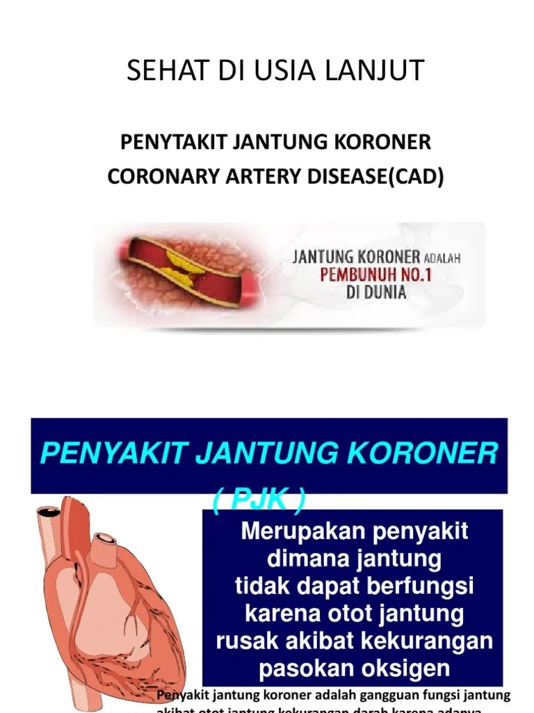 Apa Itu Penyakit Coronary Artery Disease