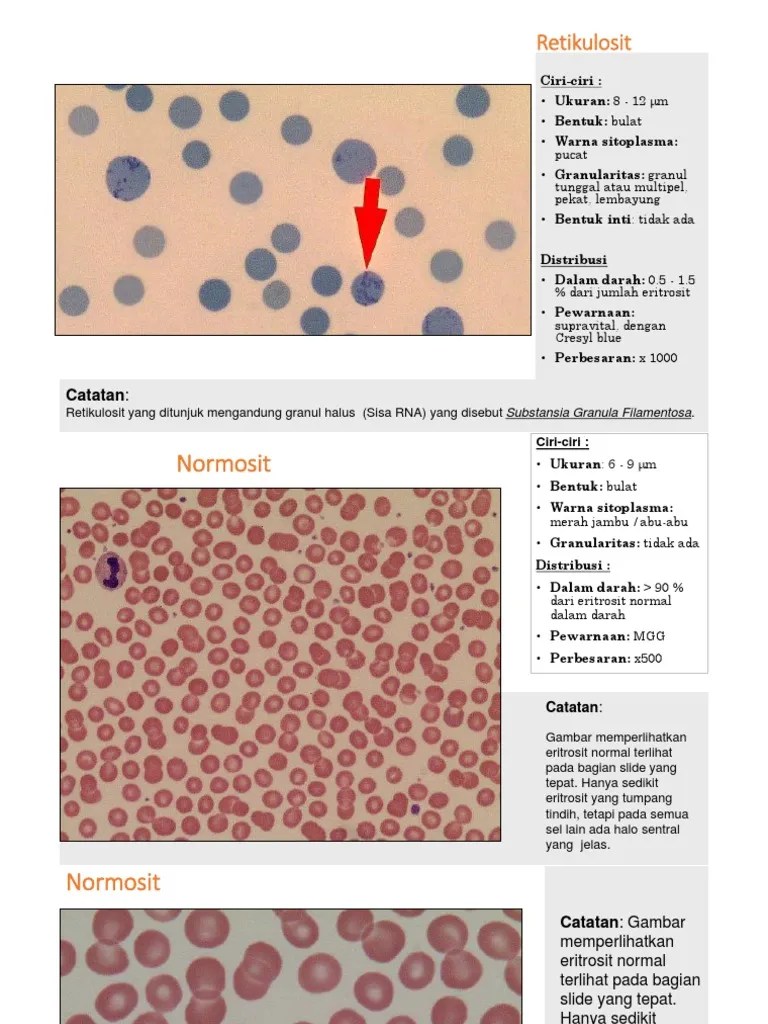Kelainan Morfologi Eritrosit | PDF