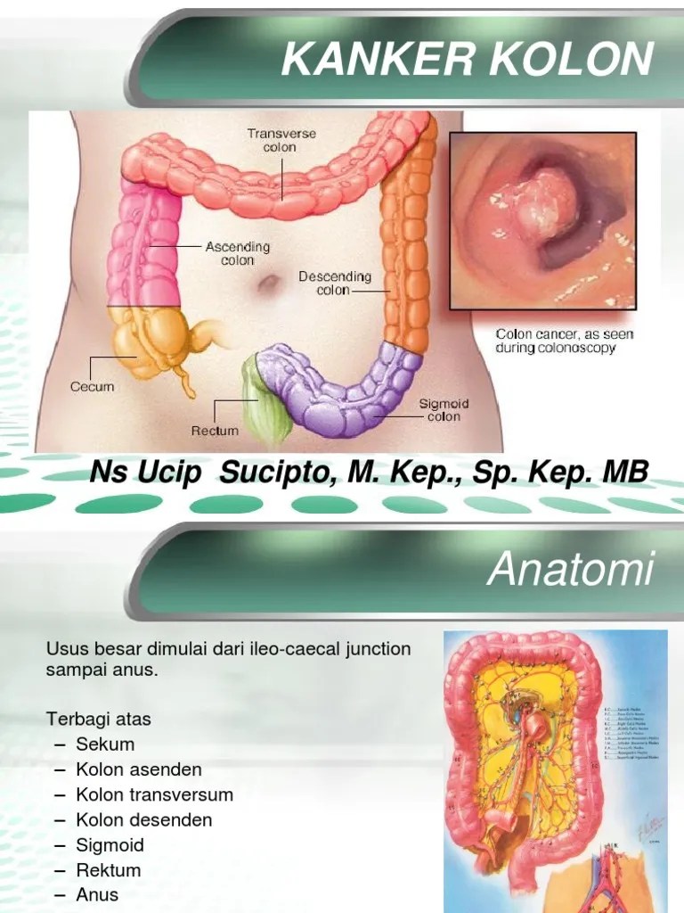 Ca Colon PDF | PDF