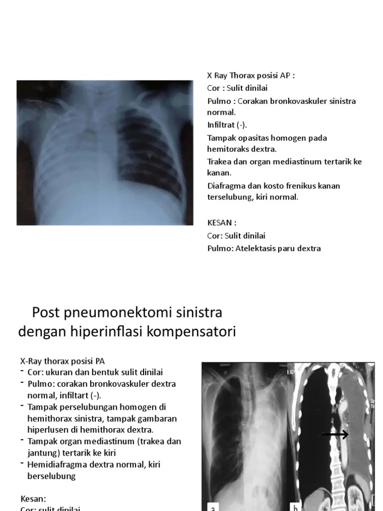 264776-GABUNGAN BON BON - Versi Jaga Harum | PDF