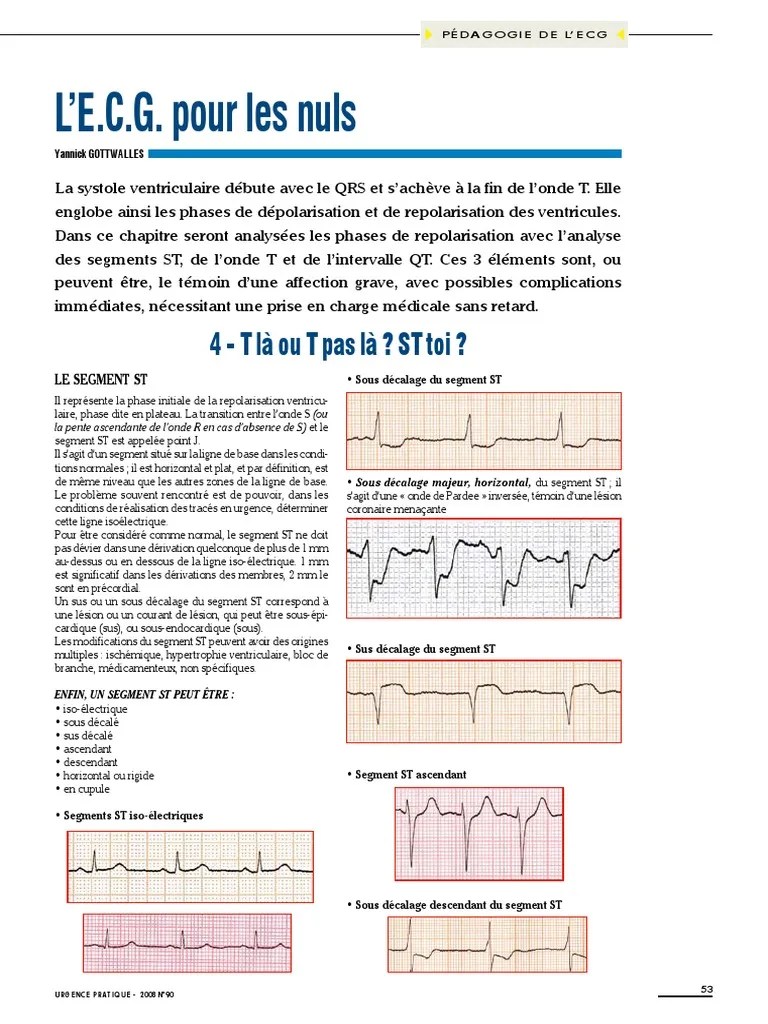 L&rsquo;E.C.G. Pour Les Nuls - Partie4 | PDF | Électrocardiographie | Infarctus  du myocarde