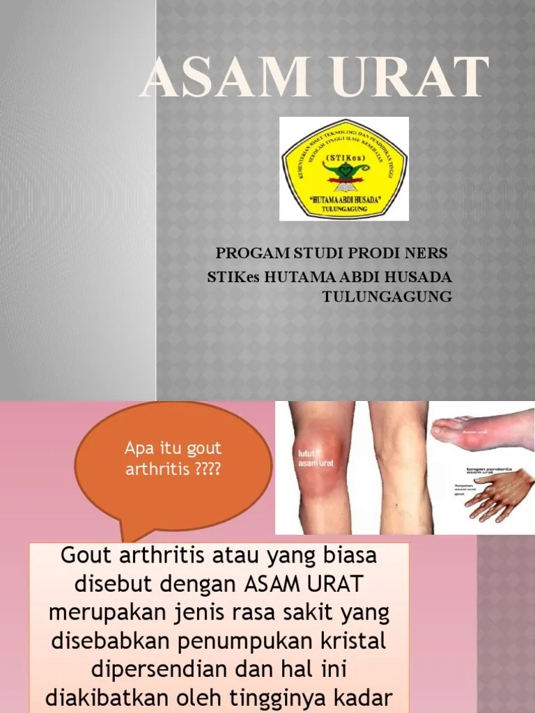 Asam urat | PDF