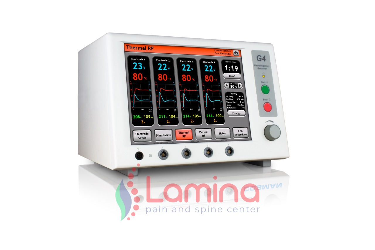 Metode Radiofrequency Ablation Pada Nyeri Atau RFA Adalah - Lamina