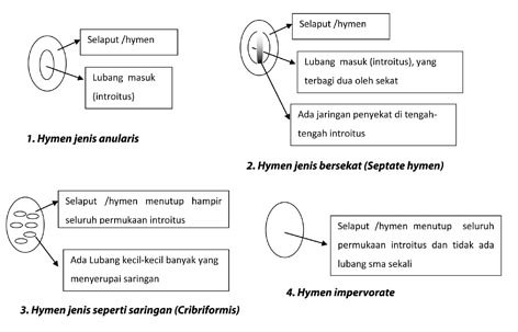 PEMKAB - Memahami Bentuk Hymen & Sulitnya Menilai Keperawanan Seseorang