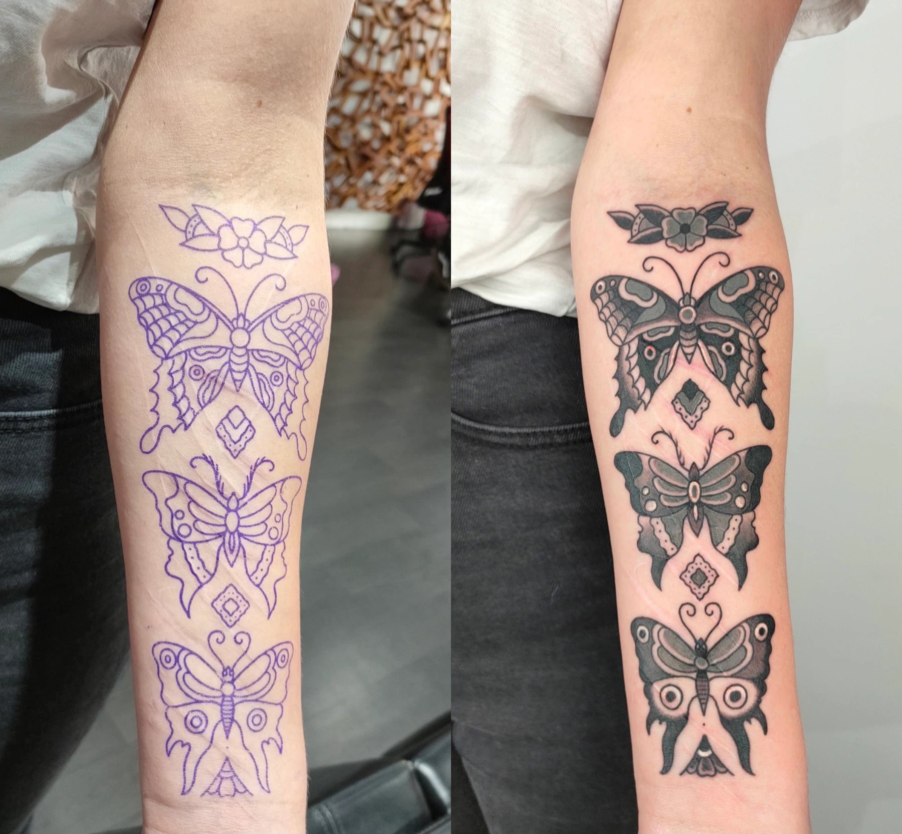 Tattoo Artist Helps Young Australians Cover Self-Harm Scars - Abc News 485_x_862_jpg