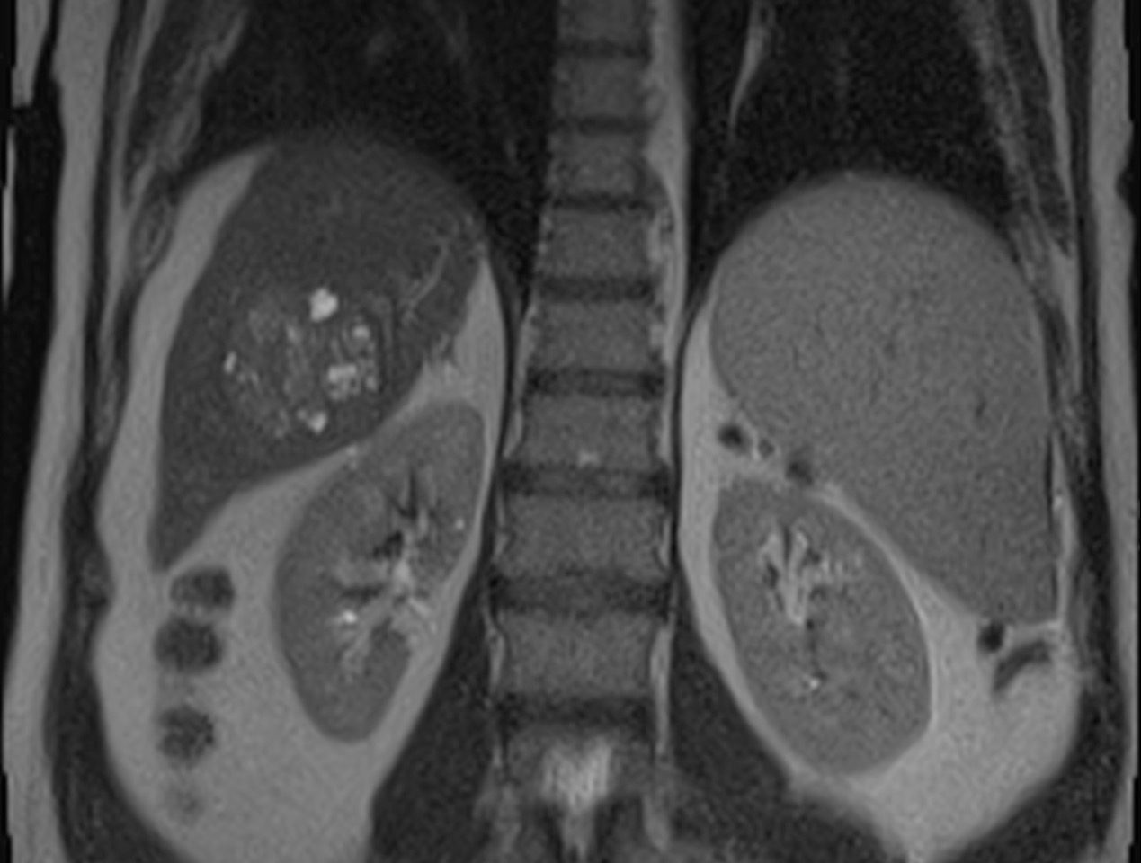 Rmn Irm Abdomino Pelvin Medinst