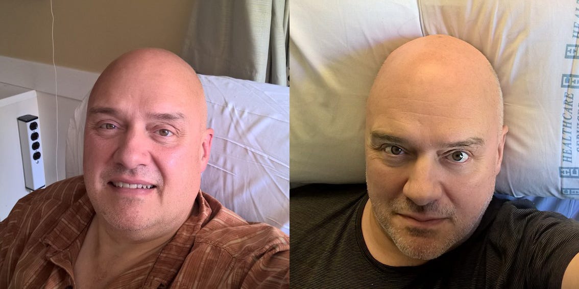 Hip Replacement Isn't What It Used To Be 12 Weeks Ago | By Doug Mahugh | Medium 567_x_1134_jpg