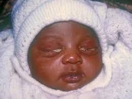 Kencing Keluar Nanah Pada Wanita. Kencing Keluar Nanah Pada Wanita _… | by permadiikhsan | Medium