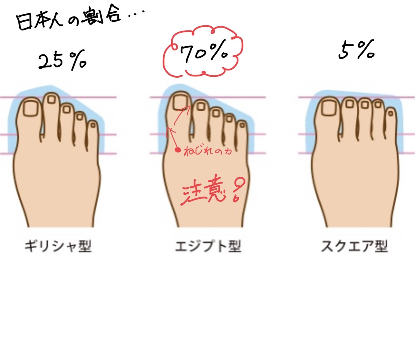あなたの足は何型ですか？ | マイオ整骨院COCO整骨院 | 武蔵小山、戸越銀座で肩こり・腰痛には筋・筋膜治療