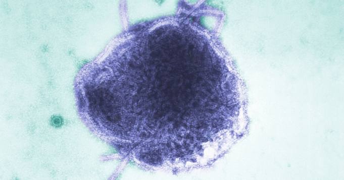 El niño de Los Ángeles muere por complicaciones relacionadas con el sarampión raras años después de la infección
