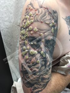 Patient Buzz: Tattoo-Related Skin Reactions - Next Steps In Dermatology 300_x_225_jpg