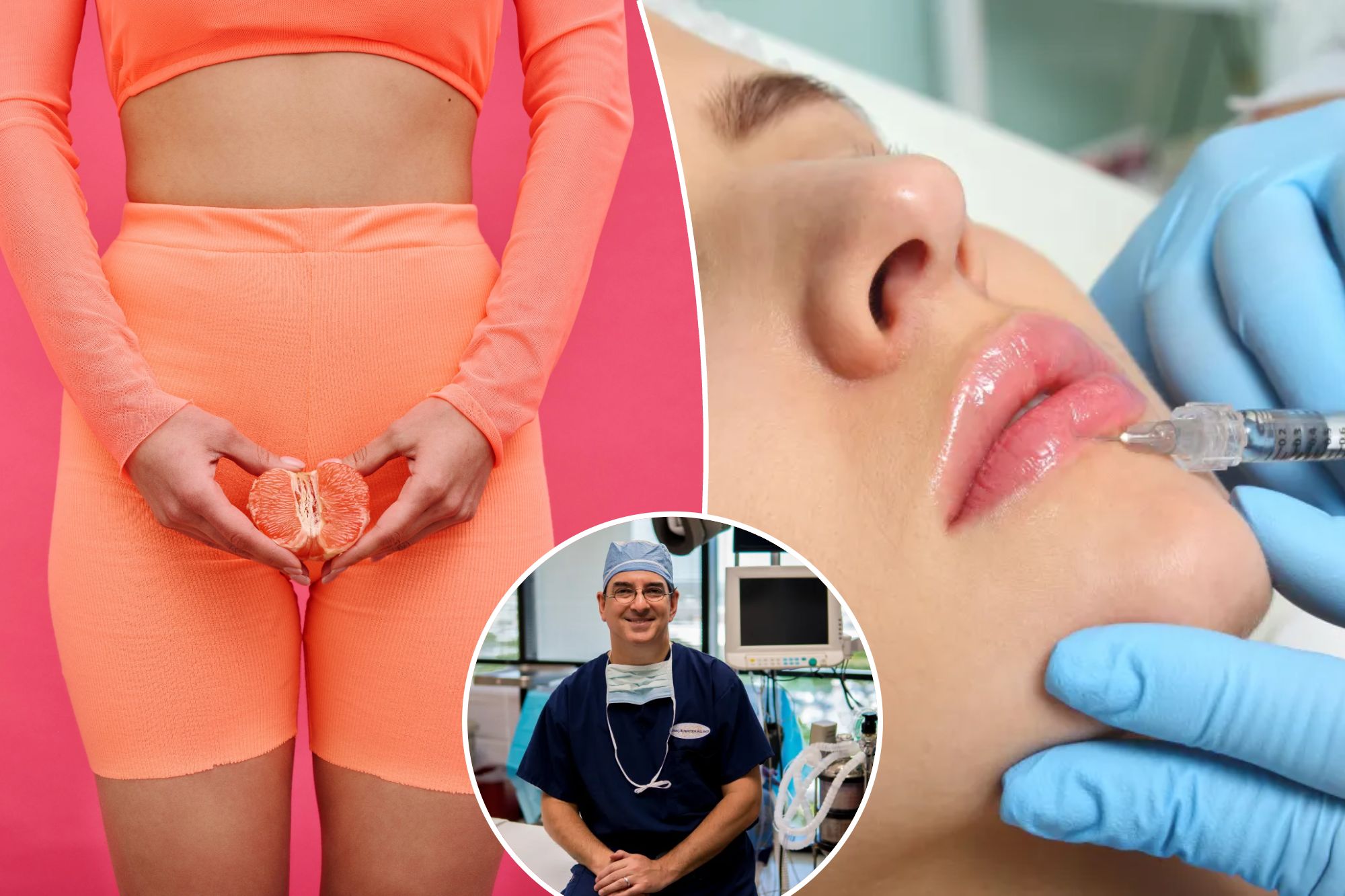Labia Puff Surgery Makes Vaginas Look More ‘Youthful,’ Say Plastic Surgeons