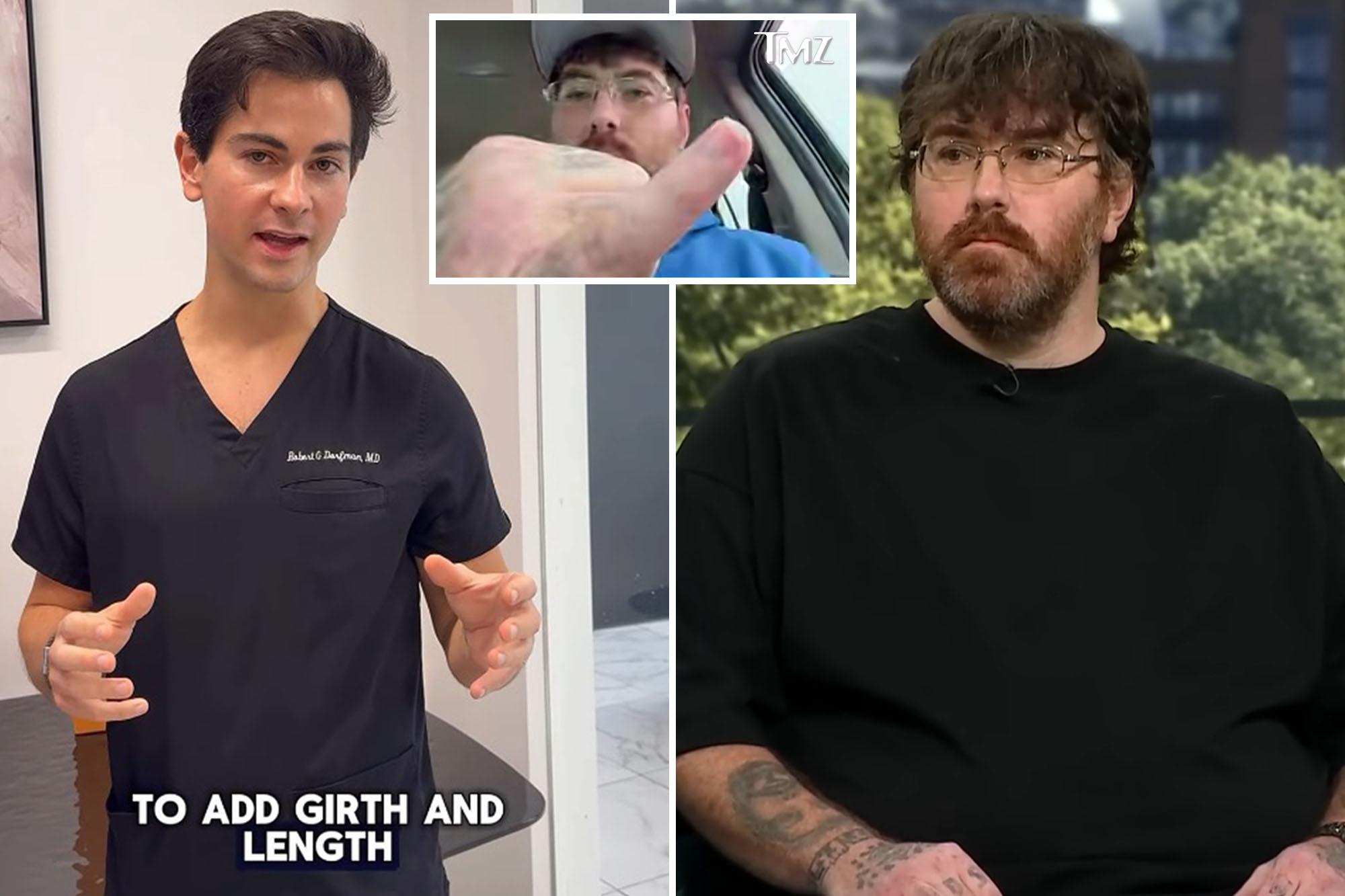 Owner of world’s smallest penis gets shot at personal growth from plastic surgeon
