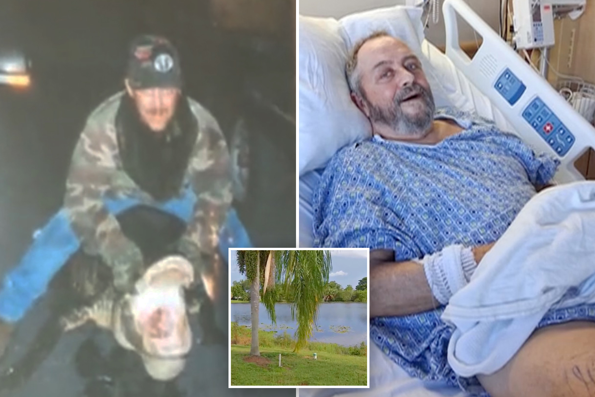 Florida senior fights off alligator attack with fishing pole: ‘No gator is going to run me off’