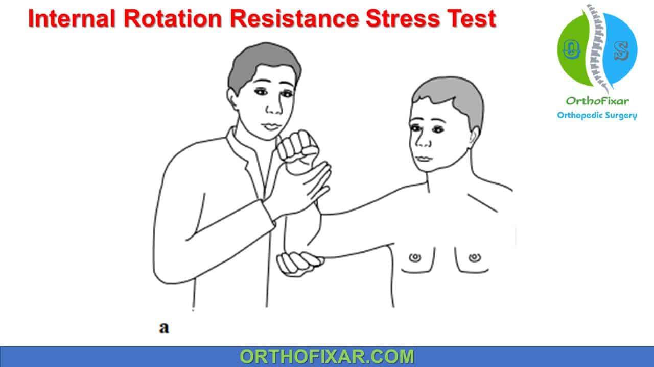 Internal Rotation Resistance Stress Test | OrthoFixar 2025