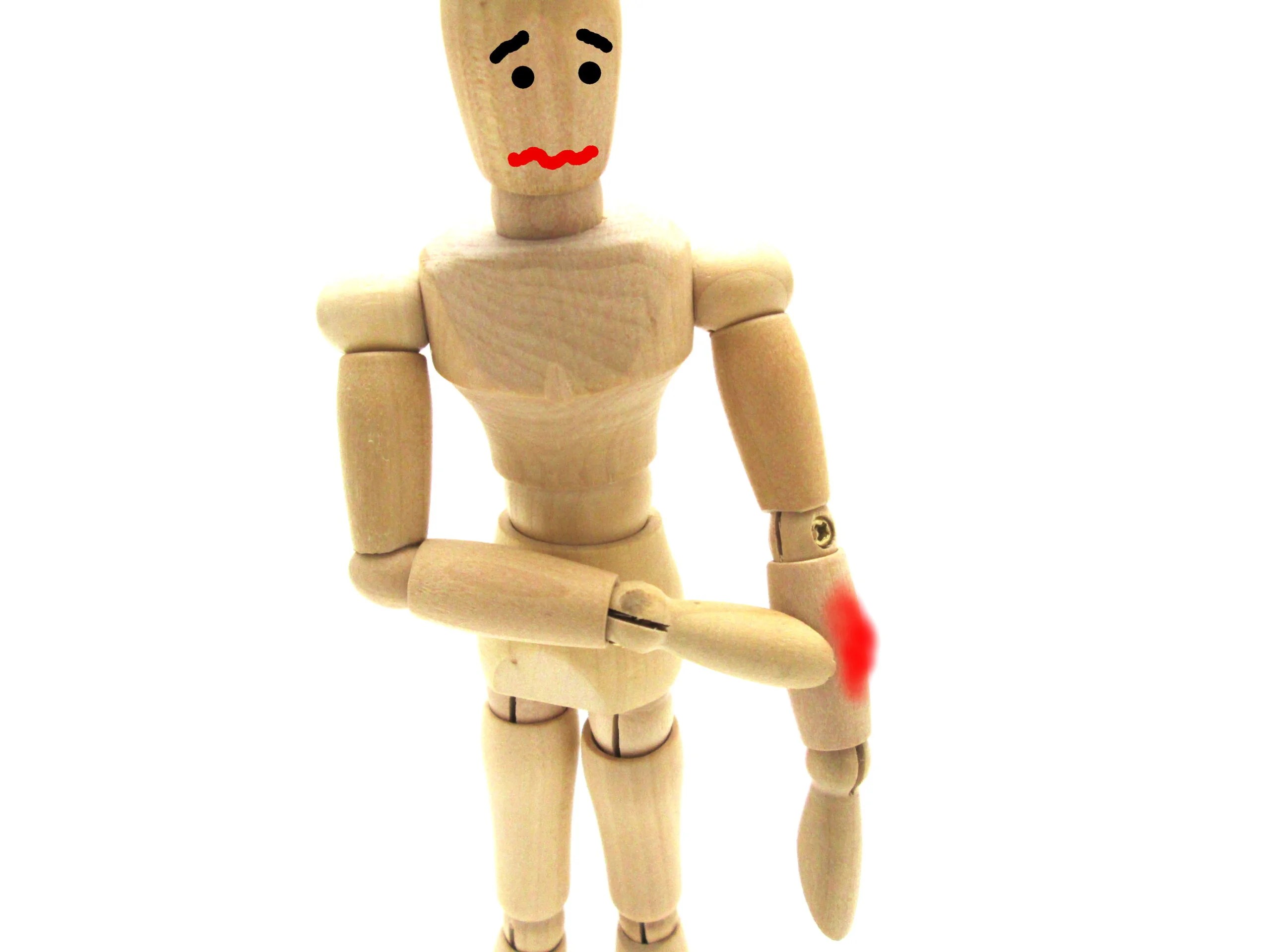 筋トレで内出血を生じた場合の対処法 | 高田馬場・目白・下落合でパーソナルトレーニングならPERSONAL TRAINING STUDIO U