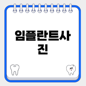 임플란트 사진을 통해 알아보는 임플란트 치료의 모든 것