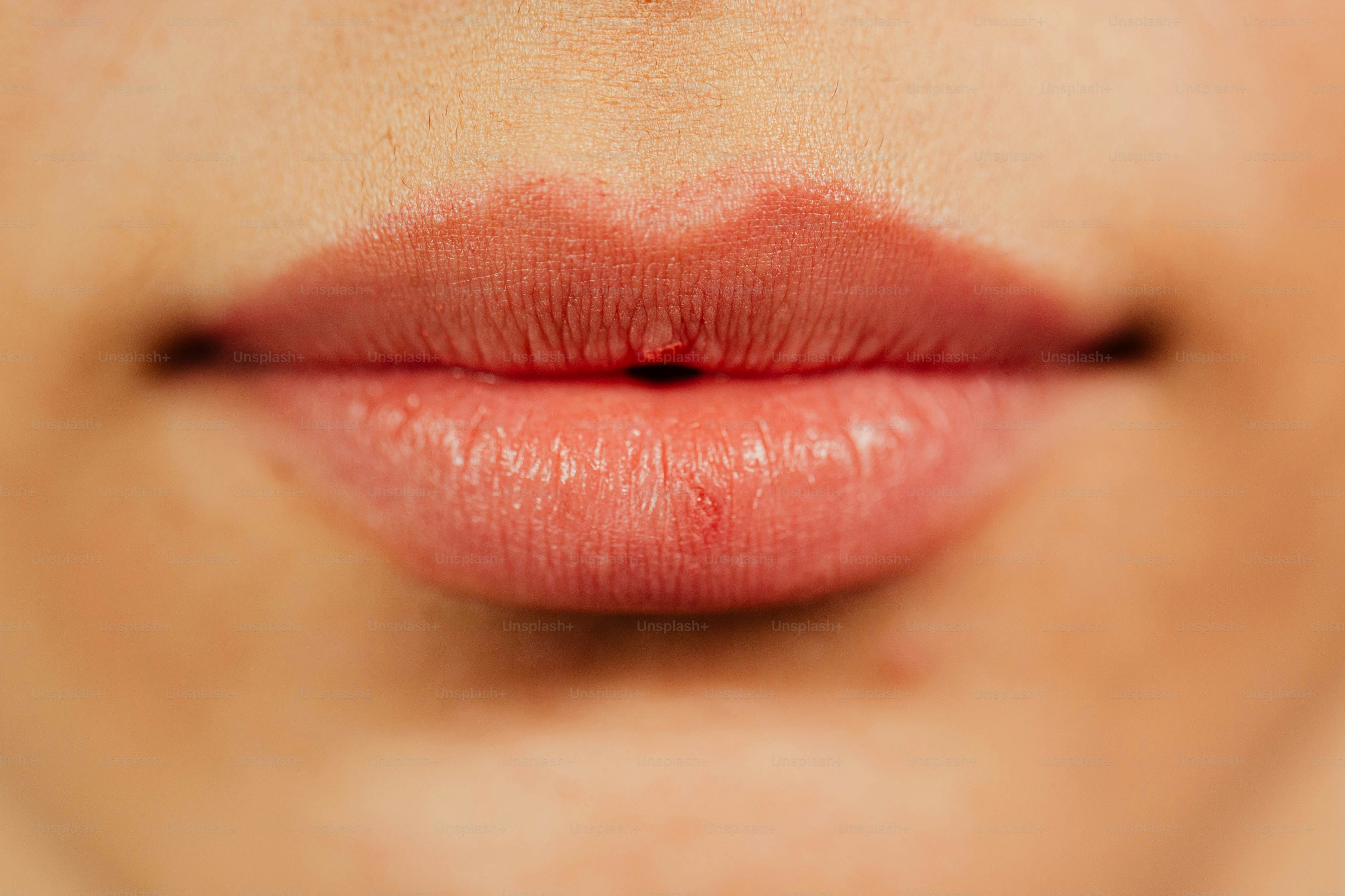 Are Lip Fillers Safe? Understanding the Risks