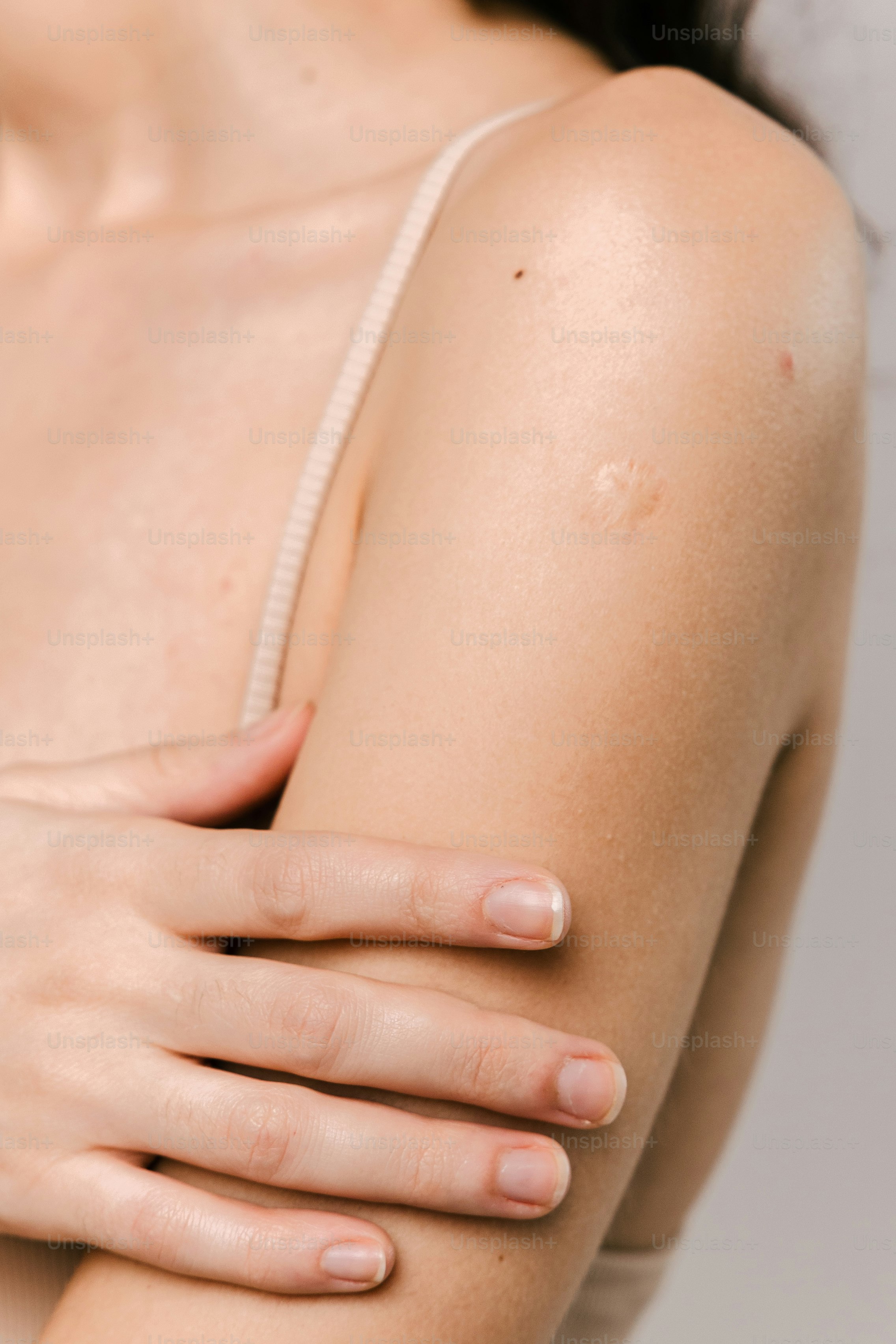 Can Microneedling Cause Scars?