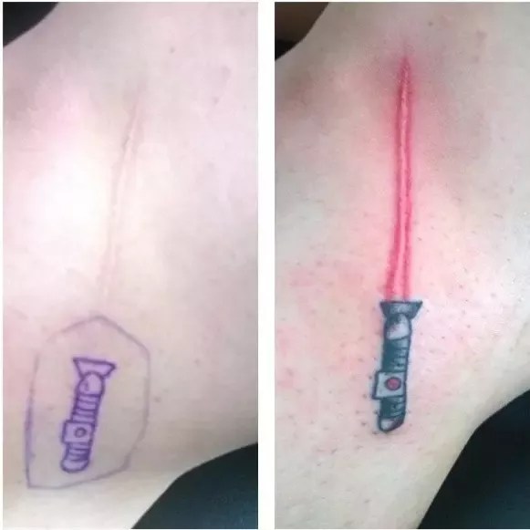 Can A Good Tattoo Cover Up Completely A Scar? - Quora 581_x_581_webp