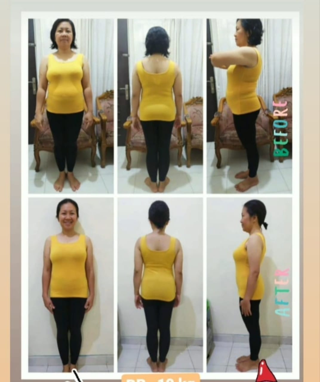 Berat badan saya 54 kg, tetapi lingkar lengan saya lebih besar dibandingkan  adik saya yang berat badannya 70 kg. Apakah ada latihan yang efektif untuk  mengecilkan/mengencangkan lengan ? - Quora