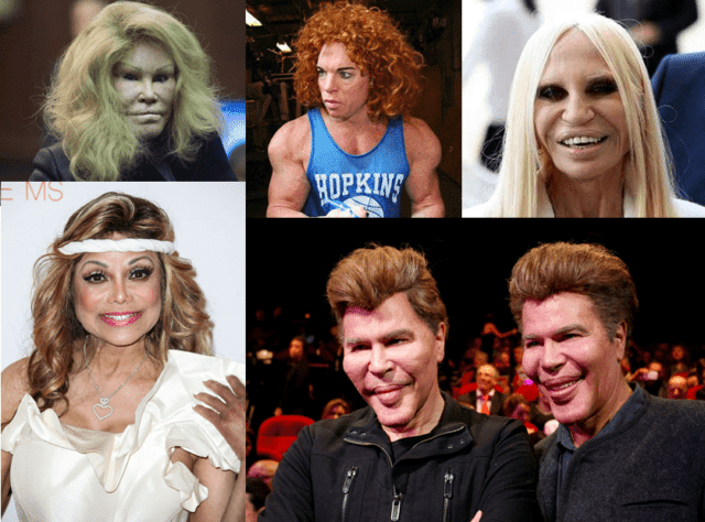 What are some celebrities before and after plastic surgery disasters? -  Quora