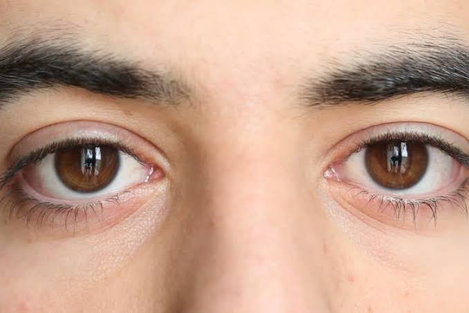 Bagaimana cara pesepak bola mengatasi masalah mata minus saat bertanding?  Apakah memakai lensa kontak? - Quora