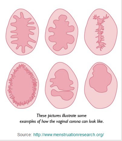Demi kepentingan riset, apasaja kah cara-cara untuk mengakali hasil tes  keperawanan? - Quora