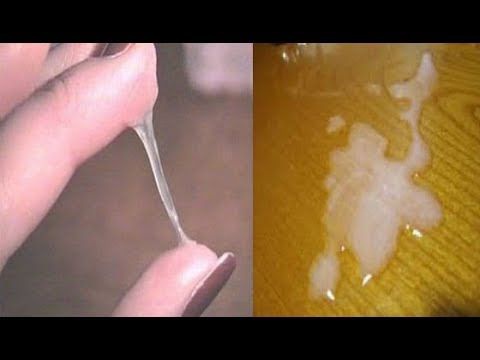 Perbedaan Sperma Kental Dan Encer - Tumbuh Tumbuhan