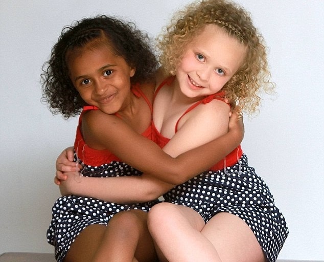 Apa yang terjadi saat ada bayi kembar tapi tidak identik? - Quora