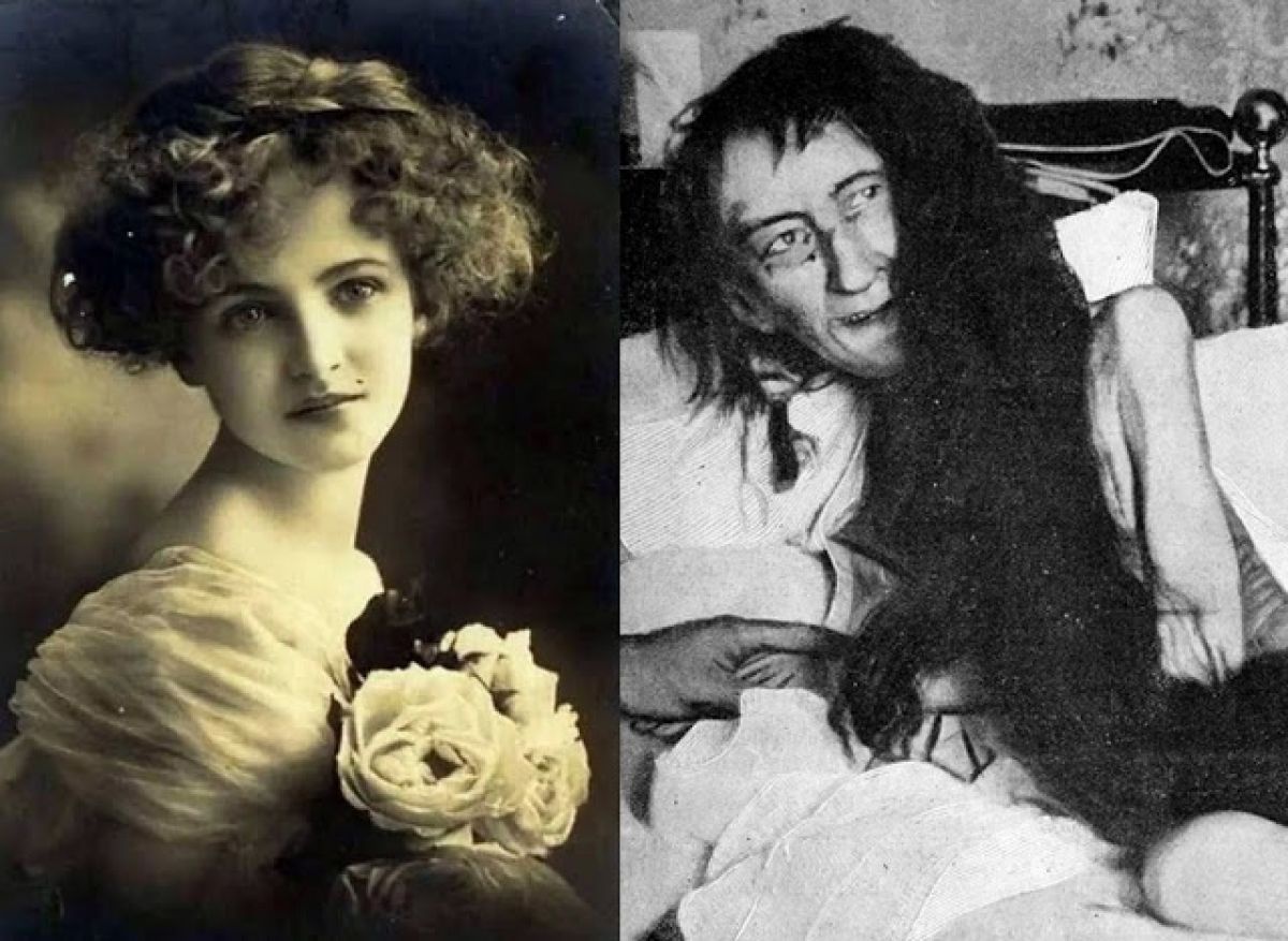 Bagaimana cara mengosongkan pikiran - Quora