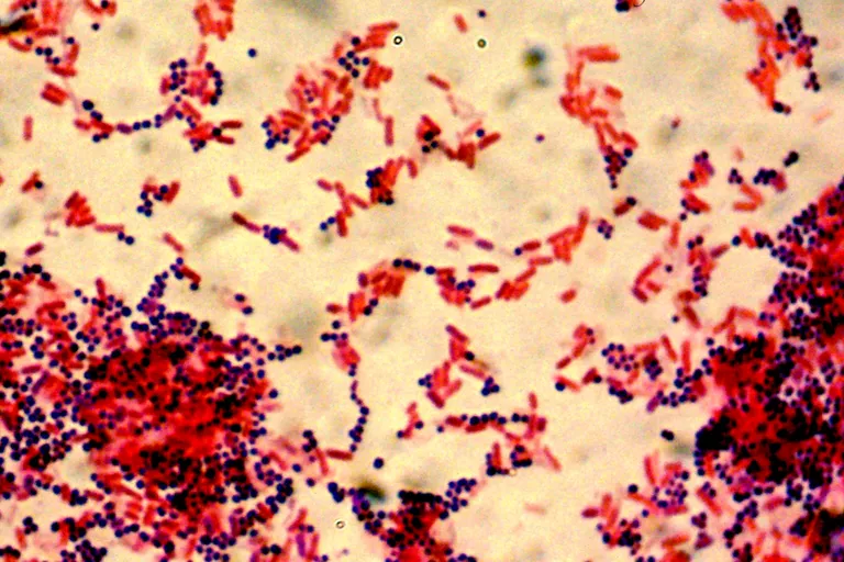 Apa tujuan pewarnaan Gram? - Quora