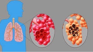 SISTEM RESPIRASI | Biology Quiz - Quizizz
