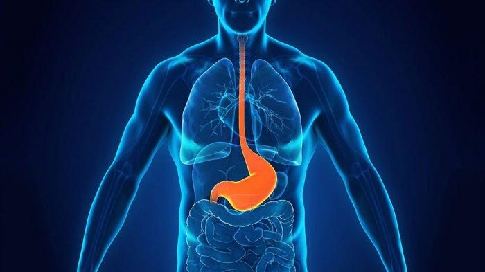 Mengenal Gastroesophageal Reflux Disease (GERD)