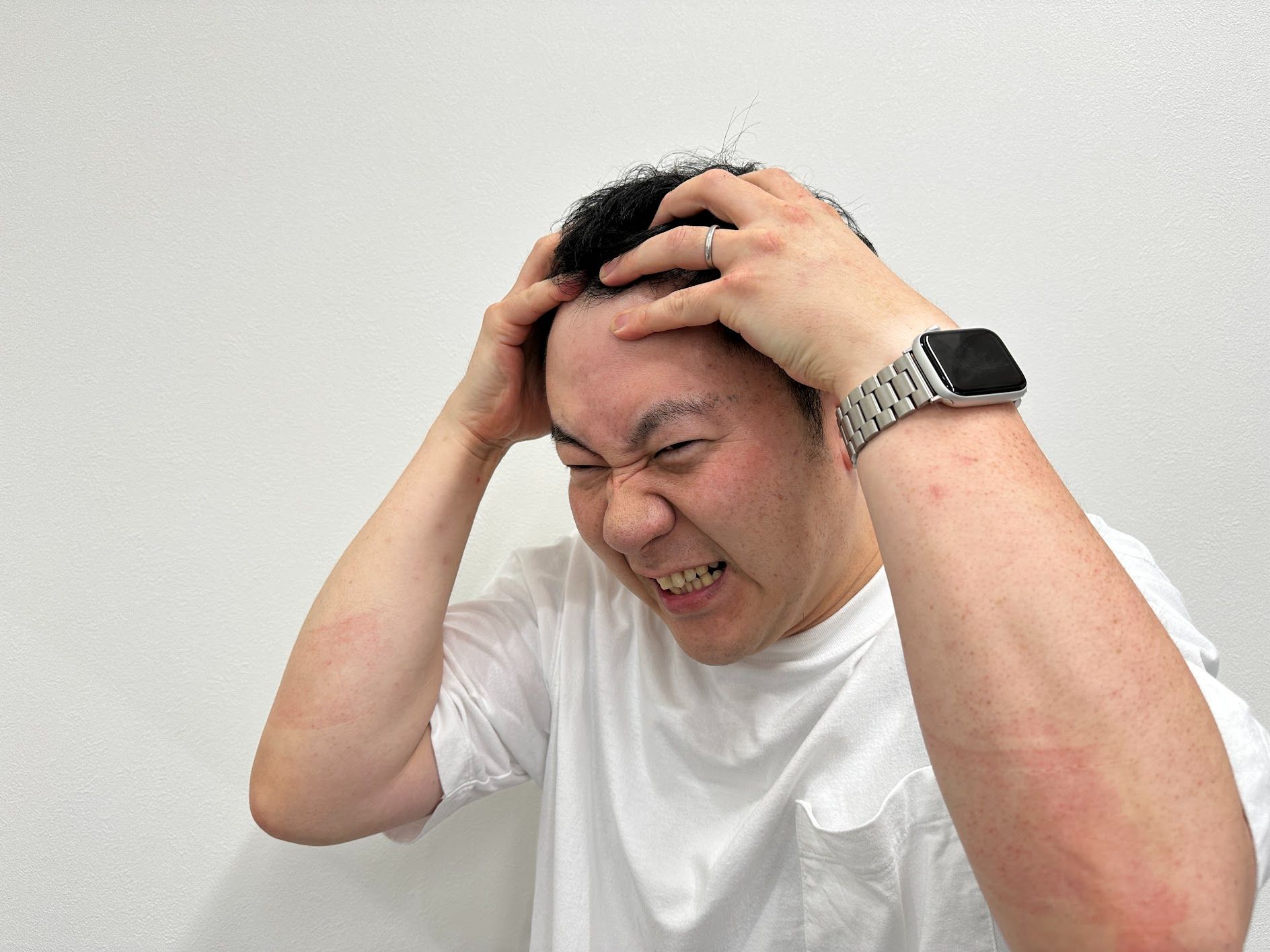 頭皮が臭い！】気になる頭の臭いの原因と対処法 - RAGCIE公式サイト〜帯広の髪質改善美容室〜