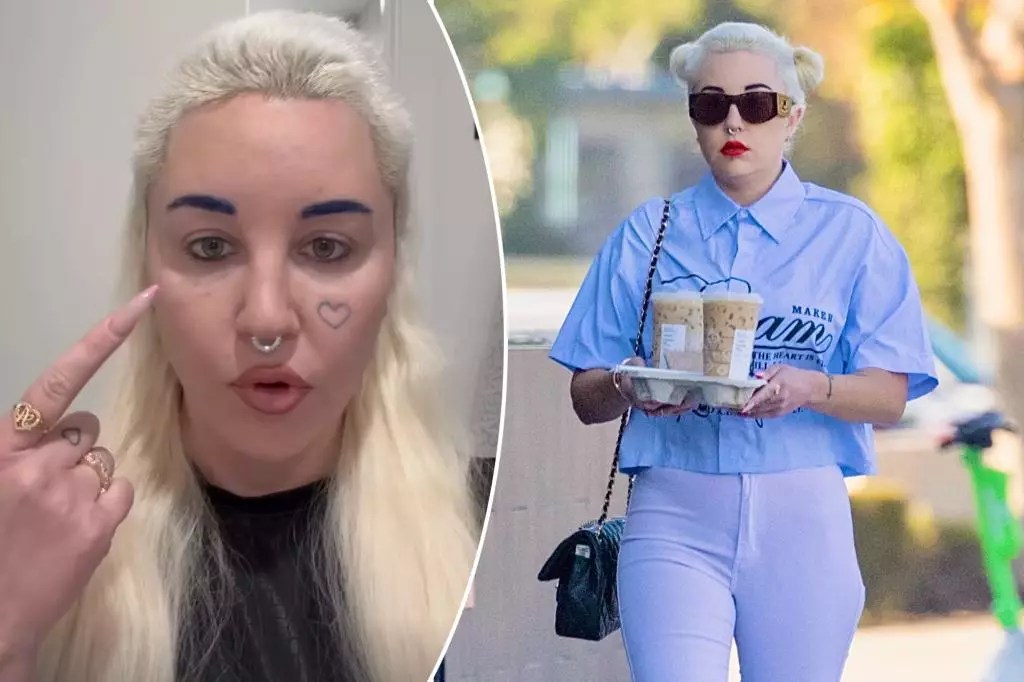 Amanda Bynes Opens Up About Eyelid Surgery and Overcoming Challenges