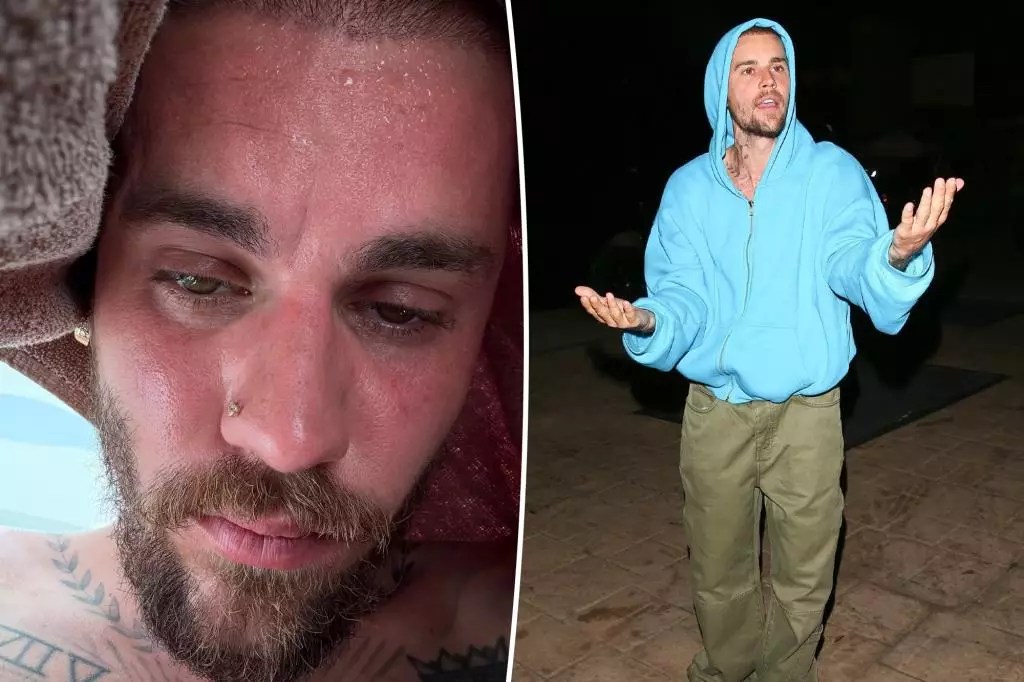 Justin Bieber’s Journey: A Public Battle for Authentic Wellness and Inner Peace