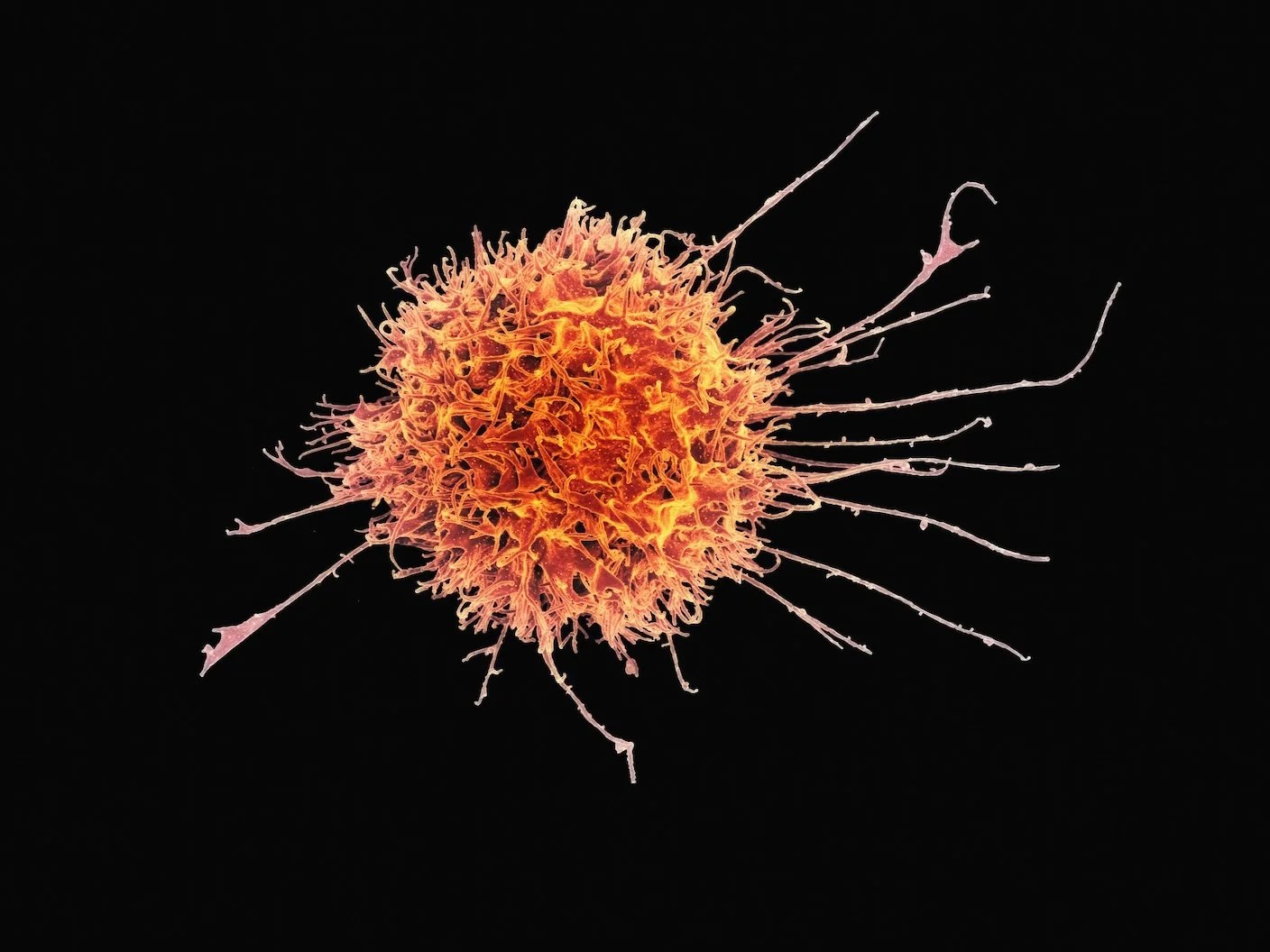 New mRNA Cancer Vaccine Wipes Out Multiple Types of Cancer in Mice