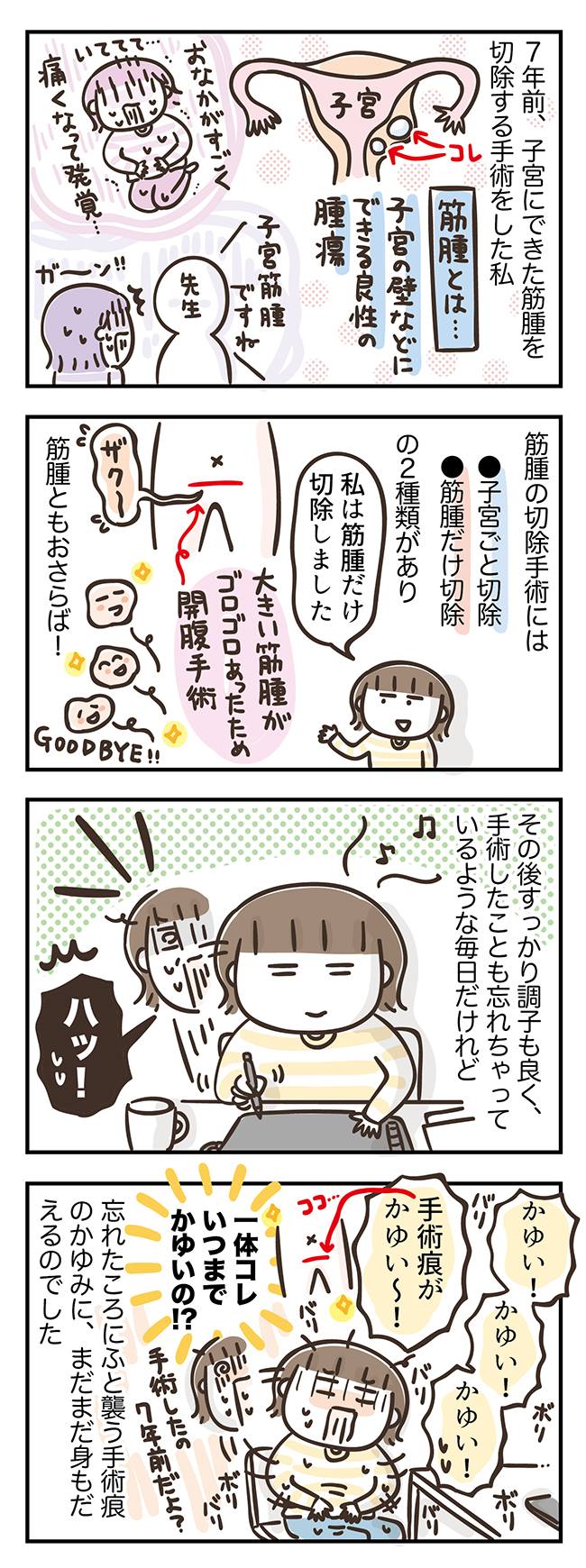 忘れたころに襲われる!」子宮筋腫の手術から7年もたったのに今でも身もだえる… アラフィフの日常 60│40代50代女性のお悩み解決|ウーマンカレンダー